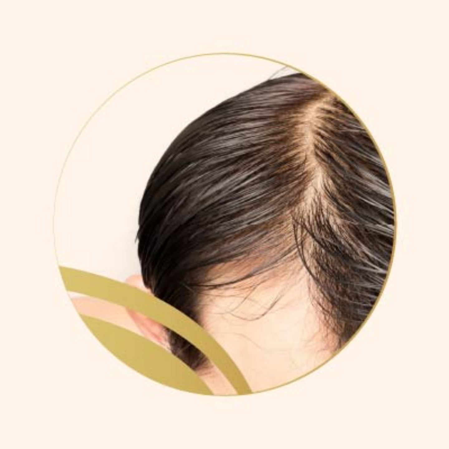 Picture for category Oily hair
